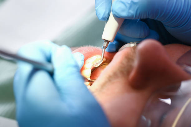 Best Emergency Broken Tooth Repair in Covington, TN