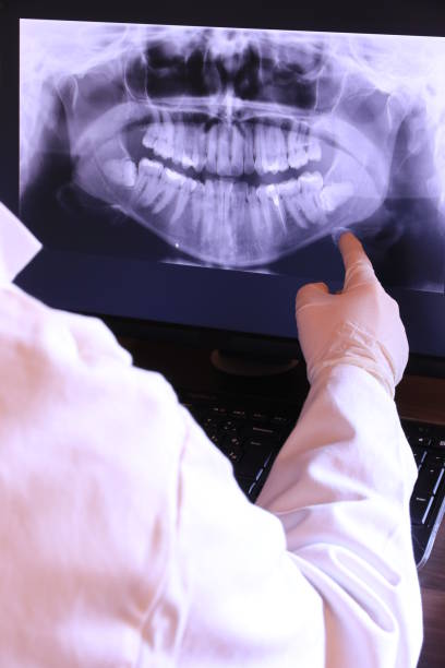 Best Emergency Wisdom Teeth Removal in Covington, TN